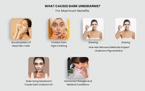 Underarm Pigmentation: Common Causes and How to Build a Gentle Skincare Routine